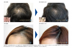 headspa_img003